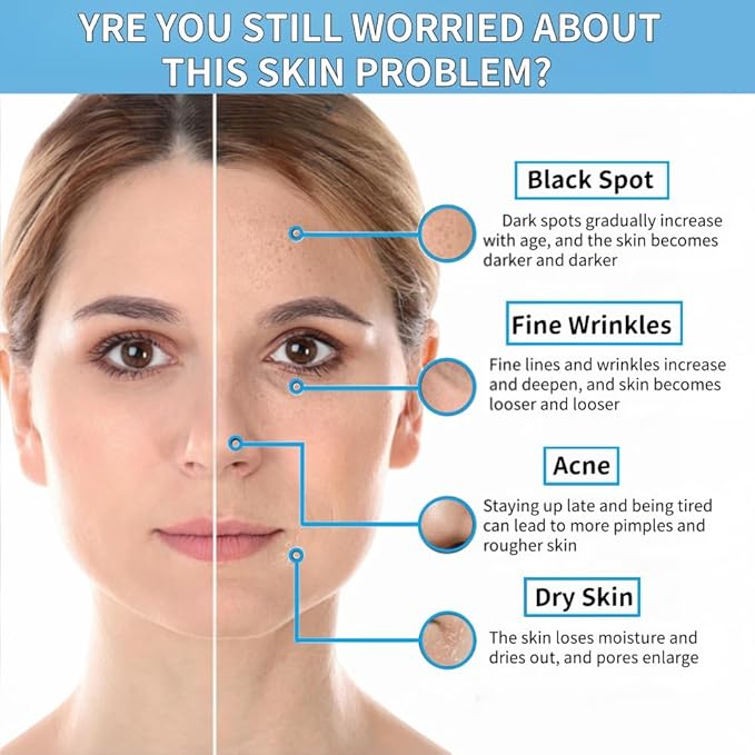 10% Niacinamide + 1% Zinc Face Serum, Nourishing & Refreshing Facial Serum , Women Serum for Oil Control and Acne 30ML/1 Fl Oz