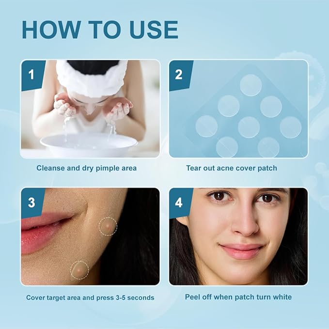 Pimple Patches for Face, Hydrocolloid Acne Patches, Absorb Zits and Blemishes, Invisible Spot Cover, Treatment for Breakouts, Acne Stickers with Salicylic Acid and Tea Tree Oil (72 Count)