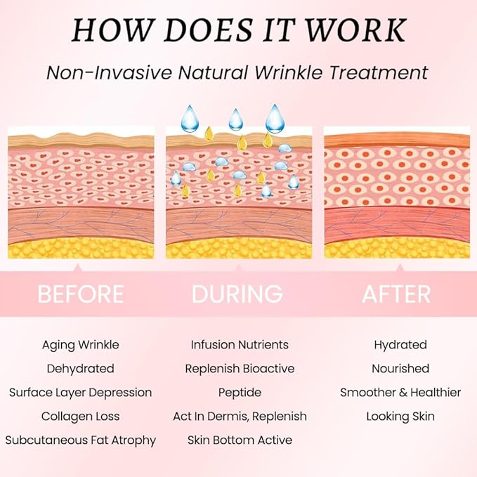 Kaely 256 Pcs Wrinkle Patches for Face Overnight, Silicone Scar Tape for Wrinkles Forehead, Face Tape for Wrinkles Overnight Sleeping Lifting Sagging Skin, Smile Line Facial Smoothing