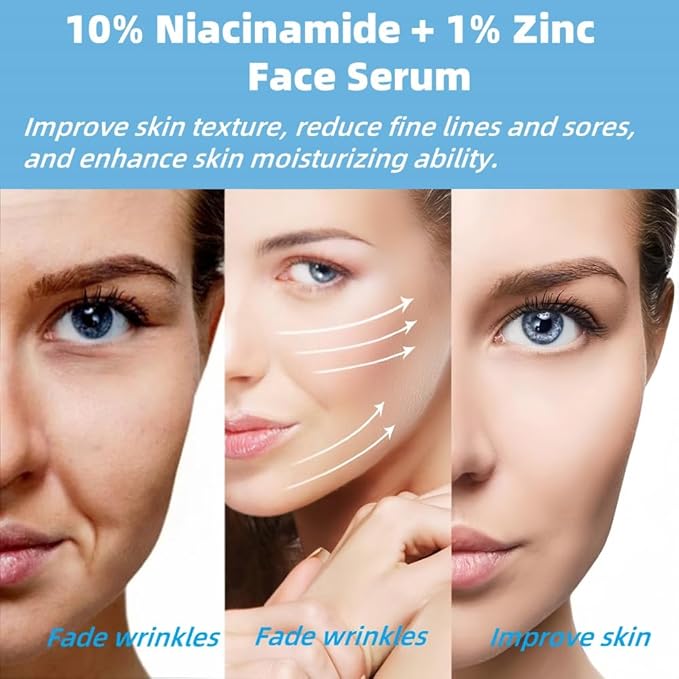 10% Niacinamide + 1% Zinc Face Serum, Nourishing & Refreshing Facial Serum , Women Serum for Oil Control and Acne 30ML/1 Fl Oz