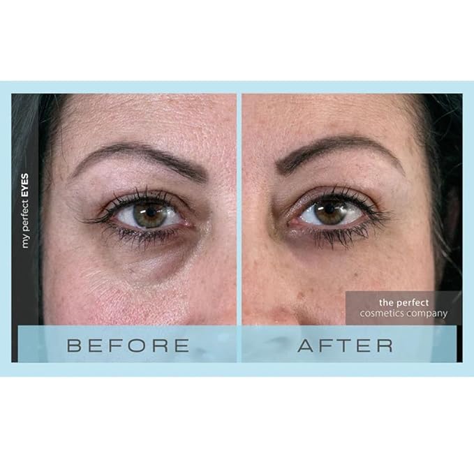 My Perfect Eyes by Penny Lane | Anti-Aging Eye Cream for Dark Circles & Puffiness | Instant Firming Treatment for Wrinkles & Fine Lines | Undereye Serum to Reduce Bags & Hollows | 20ml