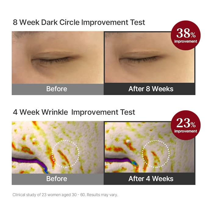 Pregnancy Safe Fermentation Peptine Eye Care Cream Under Eye Cream with 8 Peptides and Niacinamide, Anti Aging Eye Cream for Wrinkles & Crows Feet Korean Skincare 20ml 0.68 Fl Oz