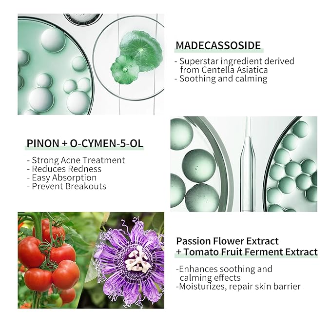 10% Salicylic Acid Serum, Acne Treatment for Face, 15ml/0.5oz, Minimize Pores, Active Skin Repair, Relieve Redness Blemish, Pimples Remover, Skin Barrier Repair for Acne Prone Sensitive Skin Care