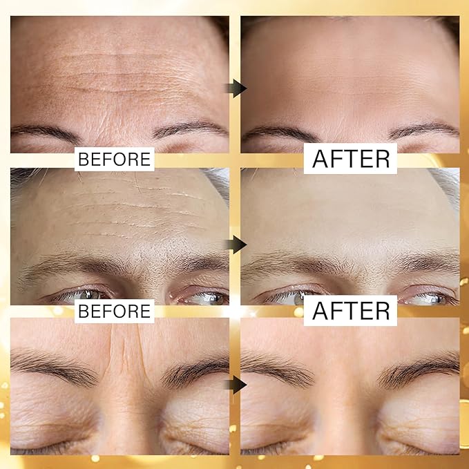 Jakuva 24K Gold Forehead Wrinkle Patches for Face-Hydrogel Pads with Hydrolyzed Collagen And Vitamin E, Forehead Wrinkles Care for Strips Moisturizing,20PCS