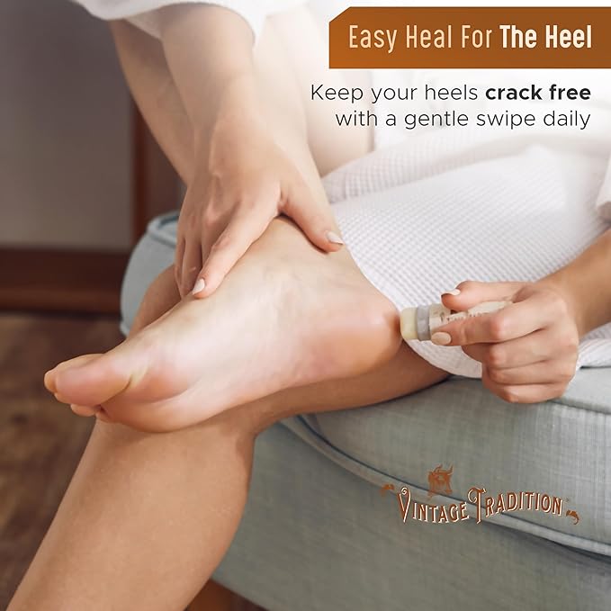 Vintage Tradition Moisturizing Beef Tallow Lip Balm – Tube Lip Moisturizer with Citrus & Lavender Essential Oil Blend Hydrates & Soothes Dry Lips – Grass-Fed Tallow Balm for Skin Care, 0.5 Fl. Oz.