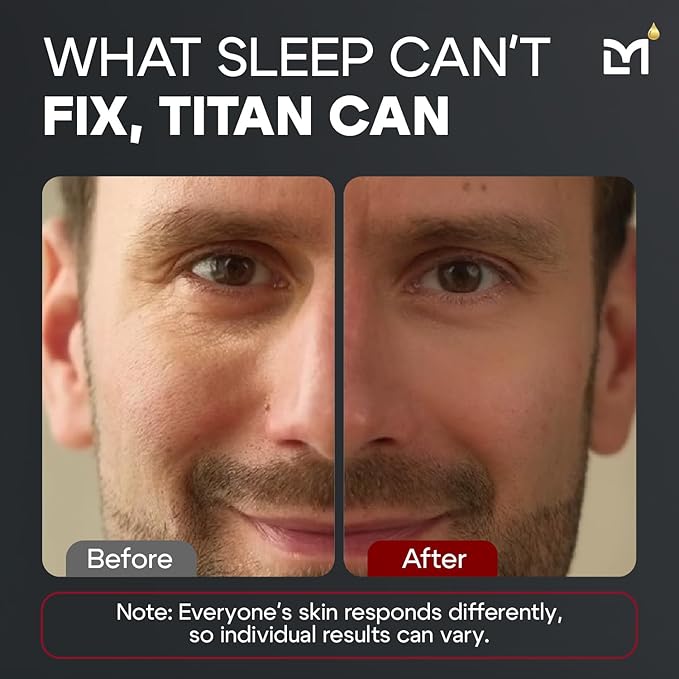 Titan Mens Eye Cream Anti Aging Bags & Dark Circle - Eye Bags Treatment for Men, High Potency Cooling Eye Gel Puffy Eyes Treatment for Men, Peptides, DMAE, MSM, Aloe, Unscented, 0.5 Fl Oz