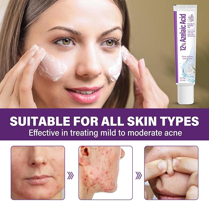 Azelaic Acid Serum, Azelaic Acid 12% Facial Cream, Hyaluronic Acid & Niacinamide for Redness Relief Face, Balance Excess Sebum, 20g
