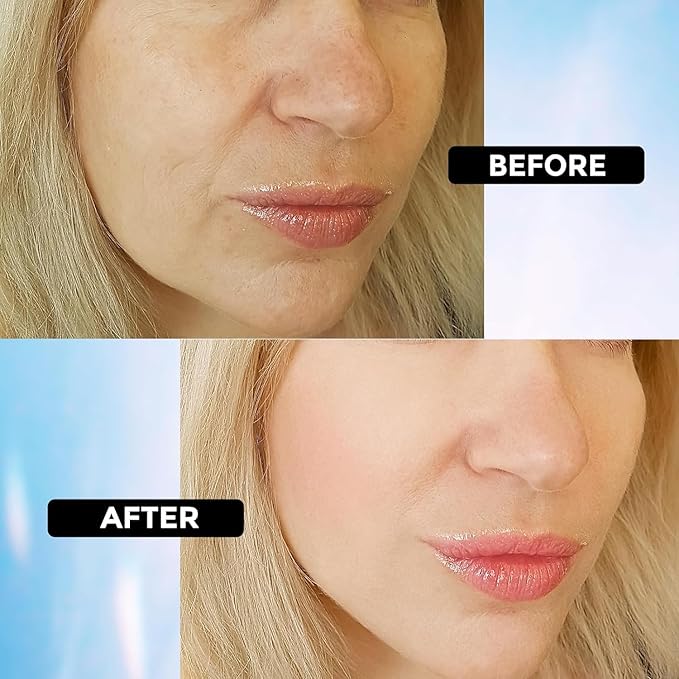 Retinol Eye Cream for Dark Circles and Puffiness, Hyaluronic Acid Serum for Face Anti Aging, Fine Lines, Dark Spots, & Dry Skin