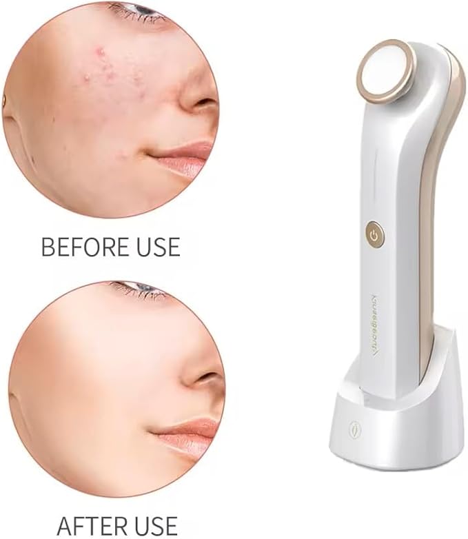 Plasma Facial Device, Ozone Skin Care Machine, Face Massager for Acne Treatment, Brightening, Anti-Wrinkle