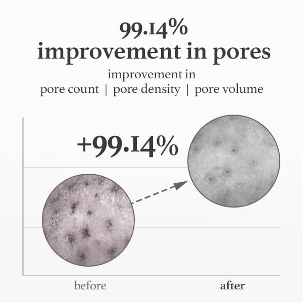 NOONI Facial Cleanser - Snow Aqua 0 LHA Toning Cleansing Oil | Makeup Blackhead Remover, Pore Control, Glass Skin, Help Control Sebum, Revitalizing, Mother's Day, 6.76 Fl Oz (200 ml)