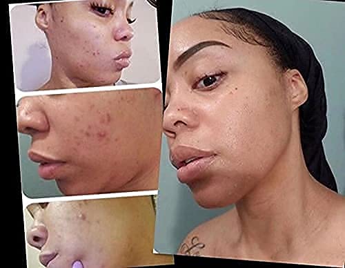 Vitamin C+ Serum Lightens Dark Spots, Repairs Damaged Skin and Helps to Prevent Signs of Aging.