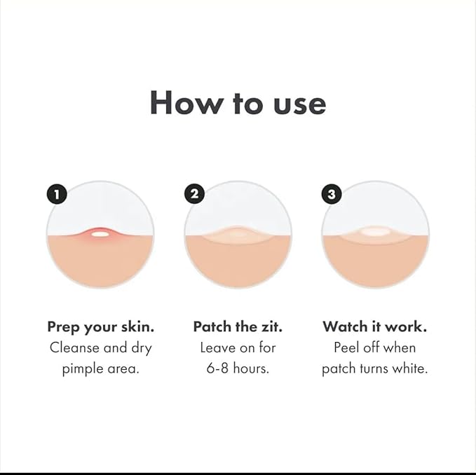 ZitZap Pimple/Acne Patches For Face And Skin, Hydrocolloid Patches With Salicylic Acid And Tea Tree Oil For Covering Zits And Blemishes.
