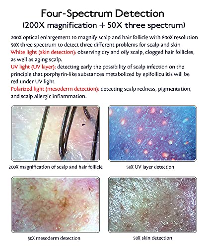 Skin Hair Scalp Detector Hair Follicle Facial Skin Oil Moisture 11 Inch HD LCD Screen Microscope Tester