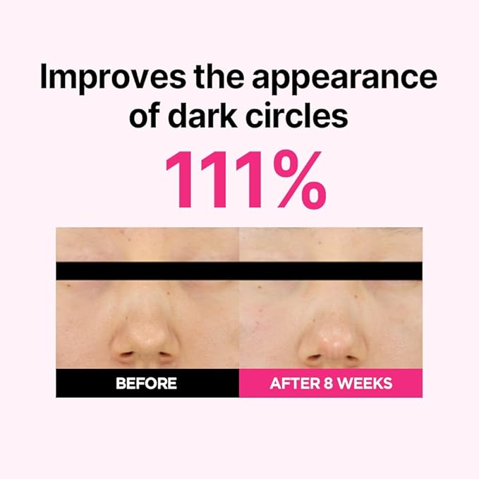 ISOI Blemish Care Eye & Wrinkle Patch, Hyaluronic Acid Eye Masks for Hydration & Firming with Bulgarian Rose Oil, Targeted Care for Fine Lines & Forehead, Korean Skin Care (90pcs, 90g)