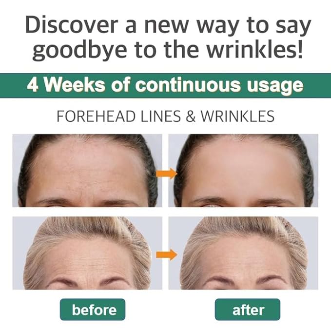 Forehead Wrinkle Patches Reusable made of Silicone | Forehead Wrinkles Treatment | Silicone Patches For Wrinkles | Non Invasive Reusable Wrinkle Smoothers…, Clear