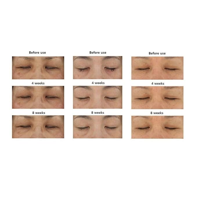 Fermentation Peptine Eye Care Cream Under Eye Cream with 8 Peptides and Niacinamide, Anti Aging Eye Cream for Wrinkles & Crows Feet Korean Skincare 45ml 1.52 Fl Oz