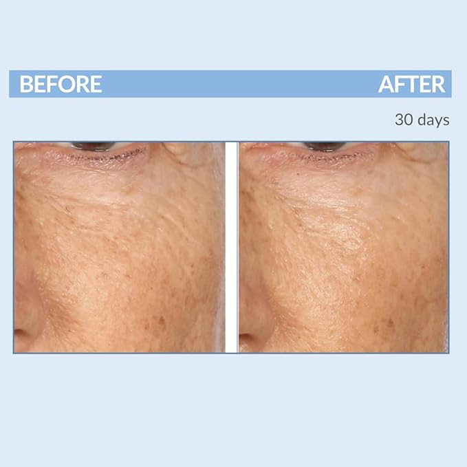 Serious Skincare - Retinol Vitamin A Eye XR Under Eye Cream Concentrate - Reduce Fine Lines, Dark Circles & Puffiness - Daily Wrinkle Cream - Anti-Aging - 0.5 oz