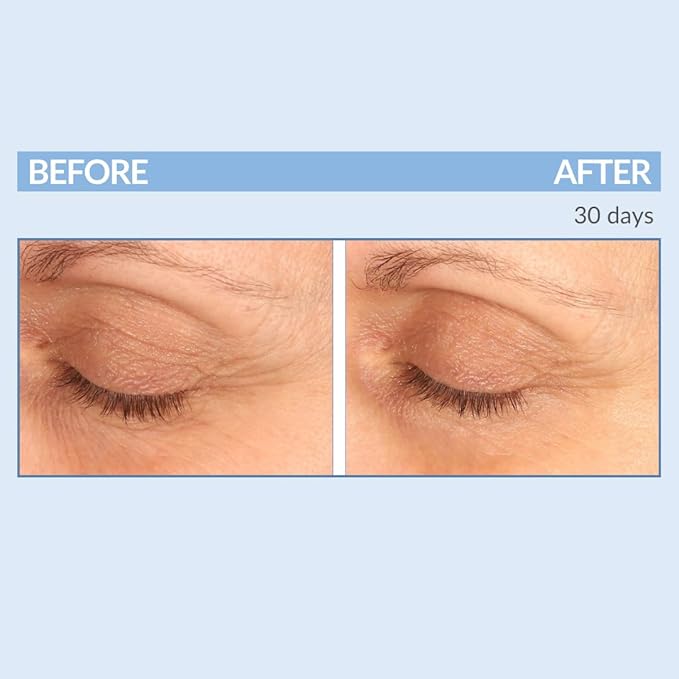 Serious Skincare - Eyetality PM Eye Night Cream with Resveratrol - Keratin & Lash Boosting Peptides for Thicker, Longer Lashes - Antioxidant-Rich to Treat Under Eye Signs of Aging 0.5 FL.Oz.