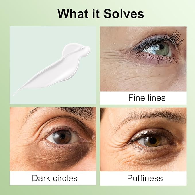 Retinol Avocado Eye Cream Serum - Hydrating Anti-Aging Treatment for Dark Circles, Puffiness, Fine Lines - Overnight Skin Care