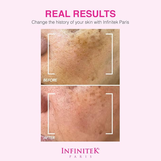 Infinitek Paris Crystal Rose Serum - Hydrating and Exfoliating Brightening Serum, Face Moisturizer and Skin Lightening Serum for Radiant, Moisturized Skin - Premium Facial Moisturizer 1 Fl Oz