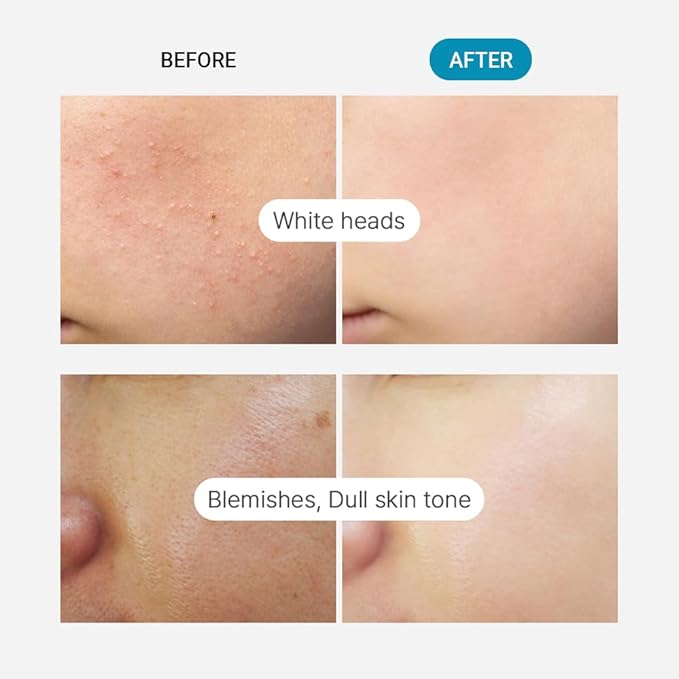 TENZERO Green Tangerine Vita C Toner Pad 70ea, 100% Natural Cotton, Moisturizing Brightening, Korean Facial Toner Pads, Blemishes Dull Skin, 160g