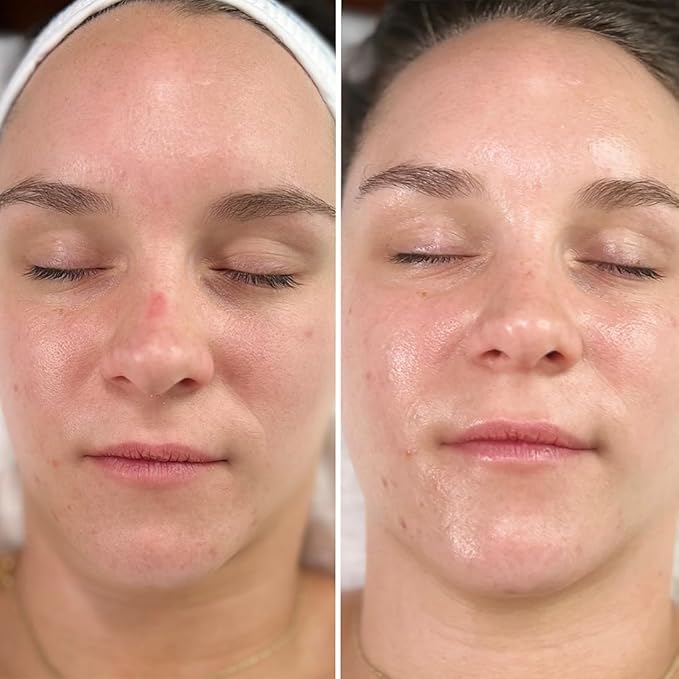 Rejuvenate Daily Serum