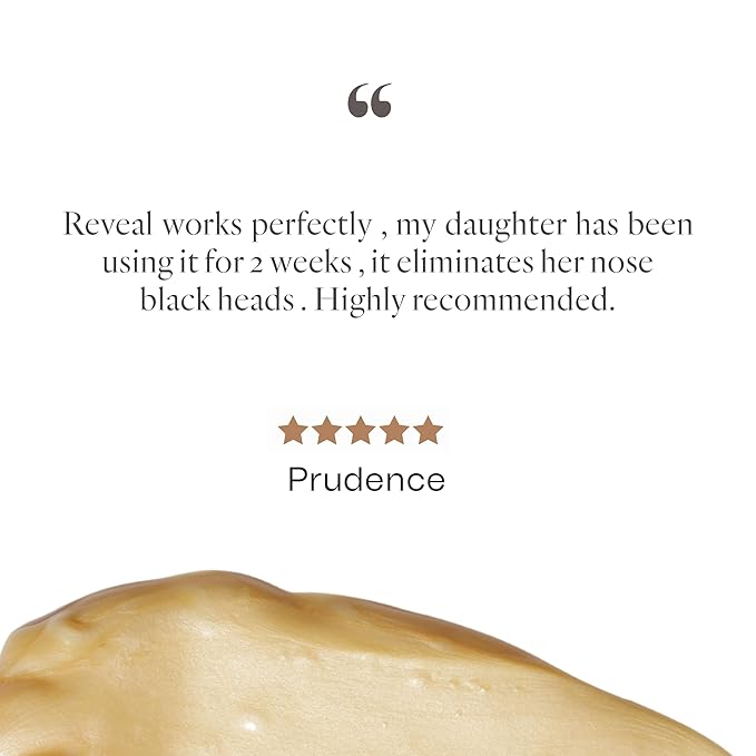 Synergie Skin - ReVeal, Exfoliating Face Serum, Pore Minimizer for Face with AHA BHA Exfoliant, Lactic Acid Serum for Reducing Breakouts and Improving Skin Tone, 30 ml