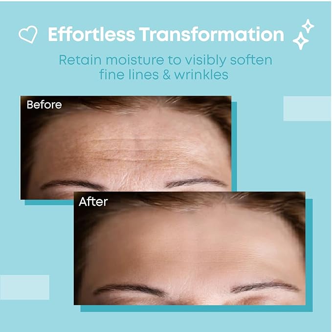 Forehead Wrinkle Patches Reusable | Non-Invasive Wrinkle Treatment for Fine Lines | Works with Face Lift Tape and Eye Patch Kits | Long-Lasting, Gentle Skin Care Solution | Includes Storage Tin