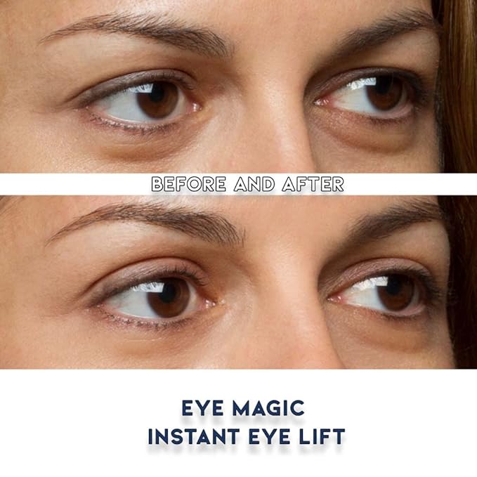 Premium Eyelid Lift (L/XL Kit + Gel) Made in the USA. Lifts and Defines Droopy, Sagging or Hooded Eyes Safe for Daily Use