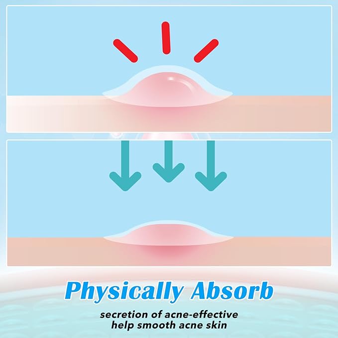 288pcs Pimple Patch Star, 2 Styles Star Pimple Patch, Cute Black Pimples Patches Stars, Skin-friendly, Breathable, Waterproof,for Covering Acne,for Makeup, Sleep, Wedding and Festival