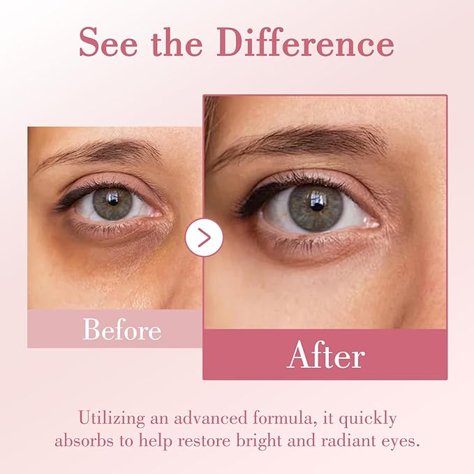 Eye Cream, Caffeine Eye Cream for Puffiness, Wrinkles, Fine Lines, Dark Circles Undereye Treatment for Women & Men, Daily Cream for Moisturizing and Hydrating, 1.05 Fl Oz