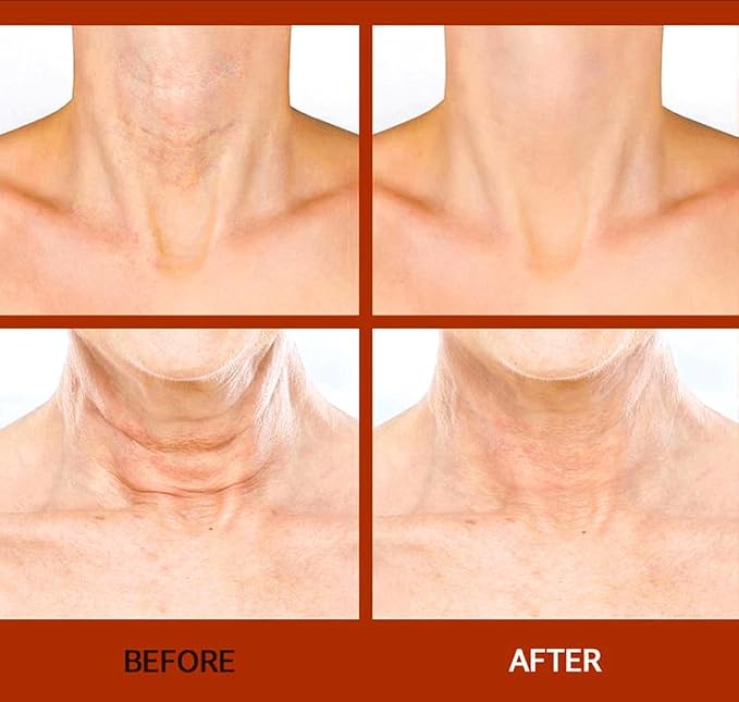 [ABSOLUTE Natural-LIFTING] Wrinkle Corrector Bakuchiol Volufiline Spicule 3000 Shot NIGHT Cream (30ml), for HIGH-END Care