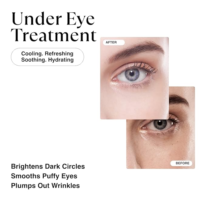 MATKAS Retinol Renewal Gold Under Eye Mask - 20 Pairs, Best Eye Patches for Puffy Eyes and Dark Circles, Collagen Under Eye Patches for Women, Gel Under Eye Masks for Dark Circles and Puffiness