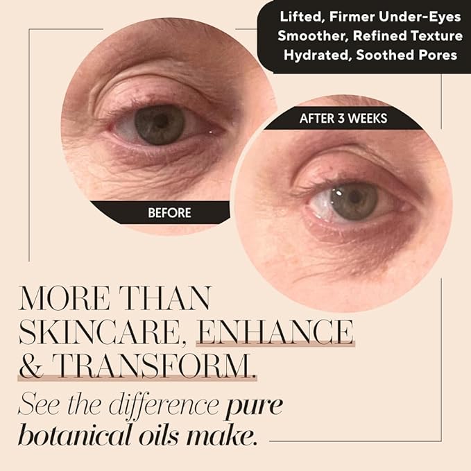 Hydrating Face Oil & Under-Eye for Women & Men – Organic Tsubaki, Calendula, Vitamin E Jojoba Oil & Rice Bran for Glowy Skin, Even Skin Tone & Dark Spots – Anti Aging Serum by Finally