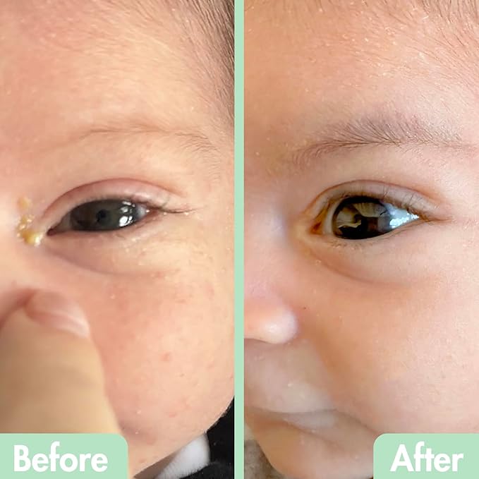 GlamBaby Eye Care - Eye Boogies™ Eyelid Cleaning Spray | Non-Toxic, Sting-Free & Wipe-Free Formula | Kids' Eyes Clean | Kids Eye Drops Sprayer | Baby Eye Drops Spray | Child Eyelid Cleanser (1 Pack)