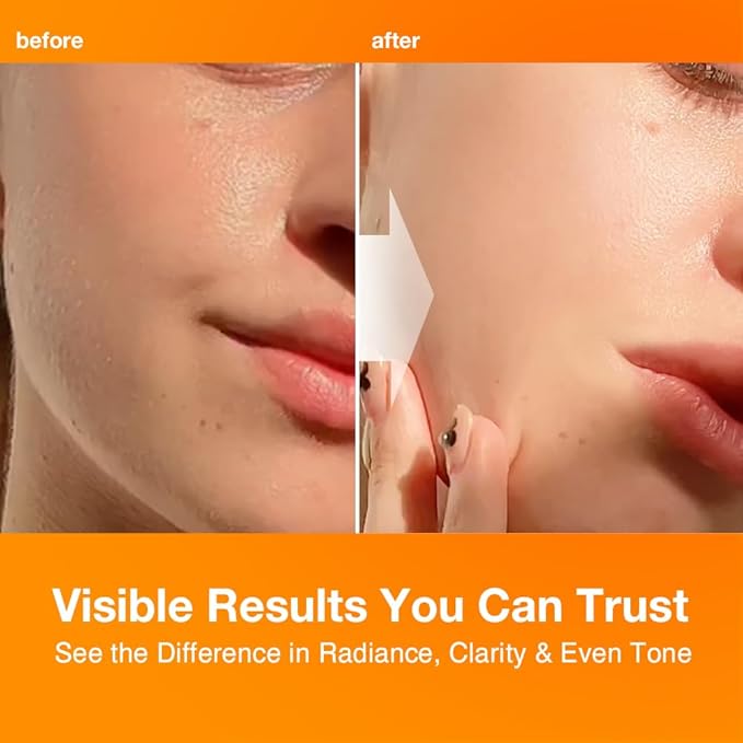 NIGHTINGALE C-TONING VITAMIN C SERUM For Face,Anti Aging and Skin Brightening with Vitamin C,Niacinamide, Hyaluronic Acid,Vitamin E,Adenosine,Reduces dark Spots, uneven skin Tone, 1.69fl.oz(50ml)