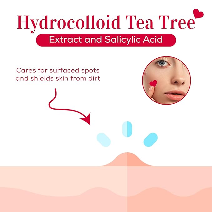 My Beauty Spot Pimple Patches Cute Acne Patches For Face (140 Patches) with Hydrocolloid, Tea Tree Extract & Salicylic Acid, Colorful Fun Designs - Pimple Patches for Face Acne Spot Treatment