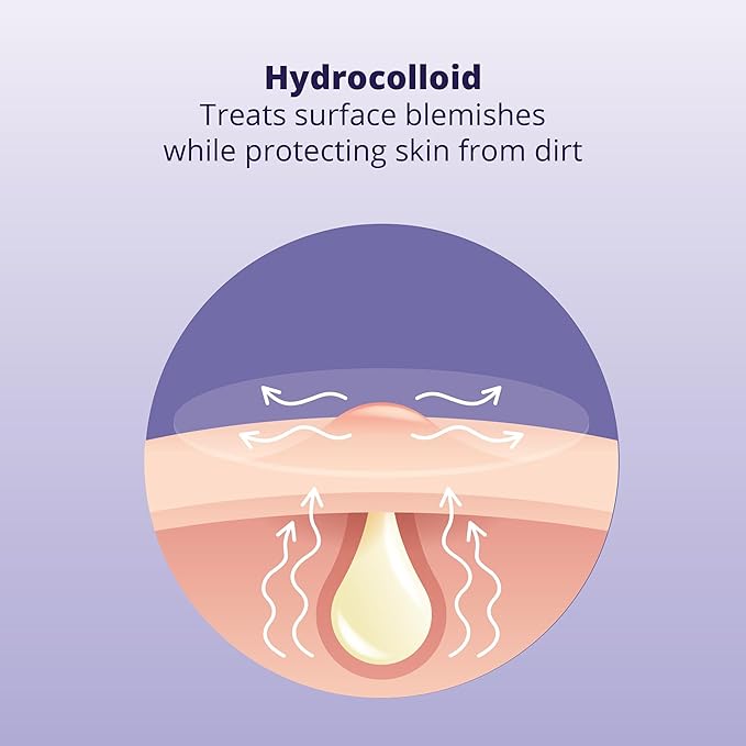 Pimple Patches for Face (96 Count). Invisible Hydrocolloid Acne Patch for Blemishes, Zits, and Breakouts. Easy-to-Use Spot Cover for Day & Night, Medium Size (12mm)