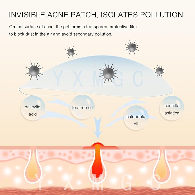 Pimple Patches for Face – Hydrocolloid Acne Patches with Tea Tree Oil, Covers Zits, Pimples, and Blemishes on Face and Skin, Multi-Size Zit Patches (240 Patches)