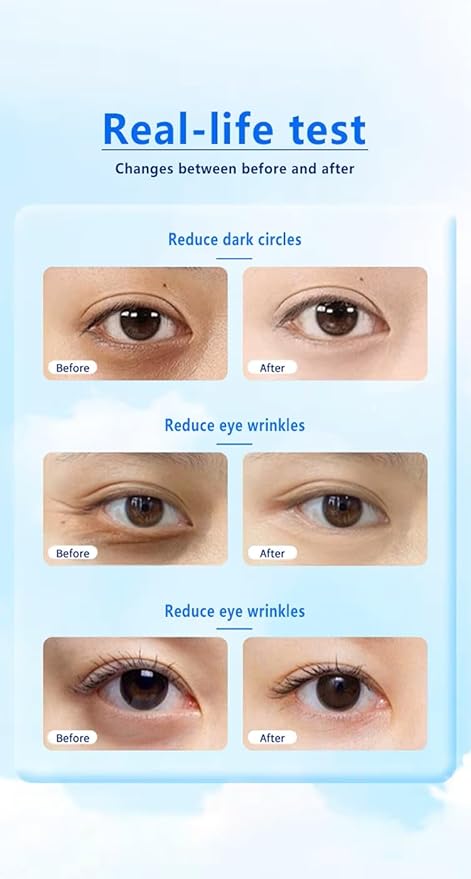 24K Gold Under Eye Treatment Mask, Dark Circle and Anti-Wrinkle, Hydrating eye mask, Puffiness & Eye Care, Collagen,Hyaluronic Acid & Castor Oil, 60 Pieces (SEAWOOD)