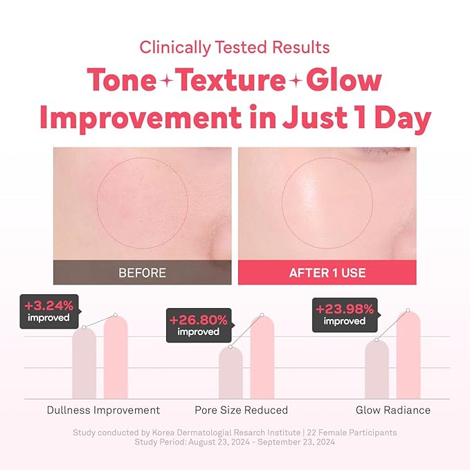 HINCE KINGSBERRY VITA NIGHT CREAM - Jelly Cream, Dullness Improvement, Niacinamide, Face Moisturizer for Dry Skin, Gives Hydration and Glass Skin Overnight, Korean Skincare (1.69 fl.oz)