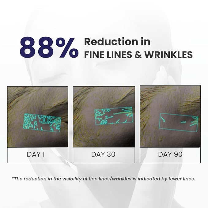 RE' EQUIL 0.1% Retinol Night Cream Repairs Wrinkles Fine Lines Improves Skin Firmness Beginner Friendly All Skin Types 30G