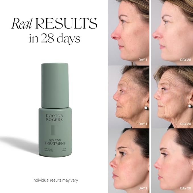 Doctor Rogers Night Repair Treatment. Restoring & Hydrating Face Serum, Anti-Aging Facial Skin Care with Glycolic Acid, Bakuchiol, & Gluconolactone, 1 Ounce (30 ml)