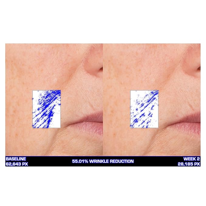 Serious Skincare Ultra-Mare Pure Marine Infusion Facial Serum - Encourages Collagen Production, Cell Turnover and Plumper Skin - Niacinamide - Acid Free - Concentrated 2 oz.