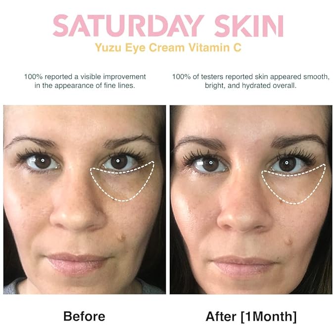 Saturday Skin Yuzu Eye Cream Vitamin C Wide lluminating Under Tight Eye Cream and Face Moisturizer Water Face Cream Natural Oil free Gel Type Cream From Alaska Glacier Water