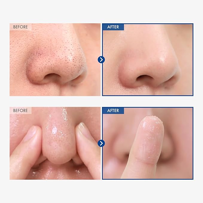 AHA Blackhead Out Cleansing Oil, Jojoba Oil, Makeup Remover, Blackhead & Pore Cleaner, Gentle Face Cleanser, Korean Skincare, 150ml, 5.07 fl. oz.