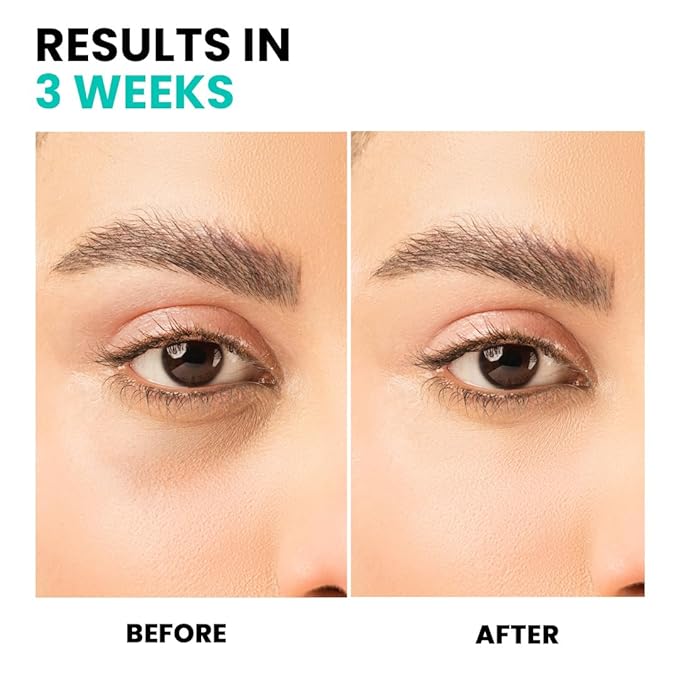 Triple Correction Eye Serum- with Anti-Aging Ingredients, Targets Under-Eye Dark Circles, Puffiness and Promotes Healthy Skin for a Visibly Revitalized Appearance, 10ml