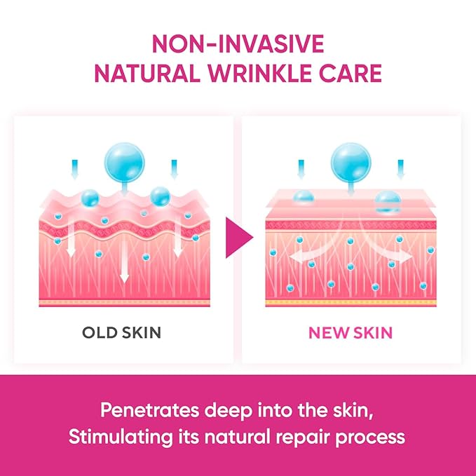 Anti Forehead Wrinkle Patches: Anti Wrinkle Facial Patches overnight- Forehead Wrinkles Treatment 144 pcs (Red(144 pcs))