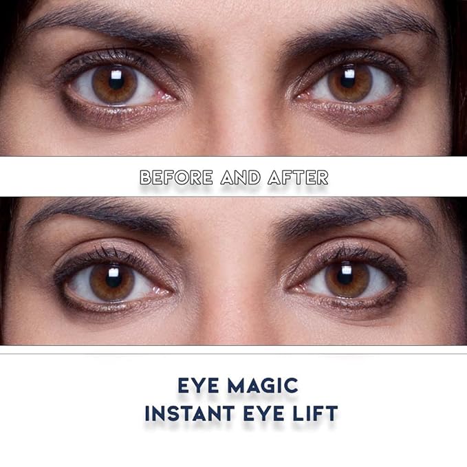 Premium Eye Lift (S/M Kit + Gel) Made in America Instantly Lifts and Defines Droopy, Sagging or Hooded Eyes Safe for Daily Use
