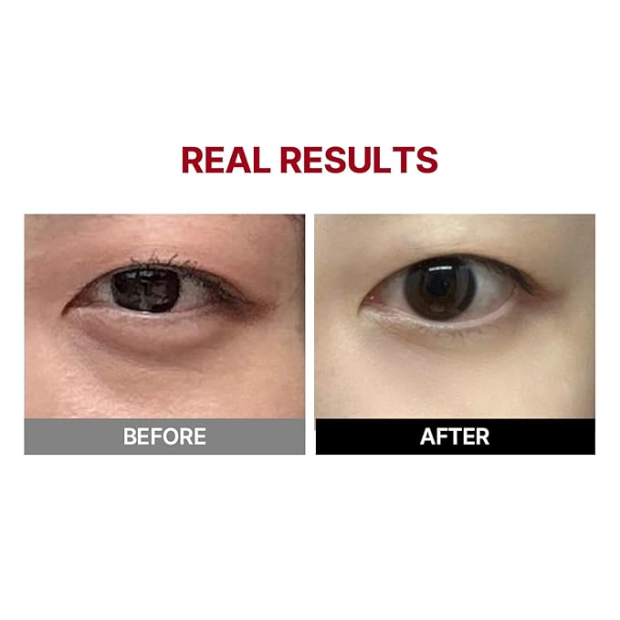 MEDITHERAPY Wrinkle-fit Tangle Eye Cream, Chargable Device Tip + Protein Collagen EyeCream, All-in-One Under Eye Treatment, 0.67 fl oz, Eye Massager (Cream+Device)